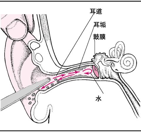 中医治疗慢性咳嗽的真实案例,这些罕见病你了解多少