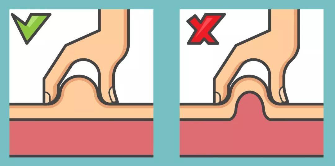 腹部胰岛素注射部位的轮换,胰岛素注射部位规范轮换意义