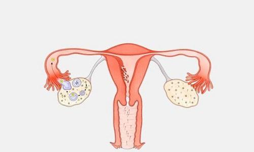 上环后月经推迟一周会不会怀孕,上环后月经会推迟多久呀