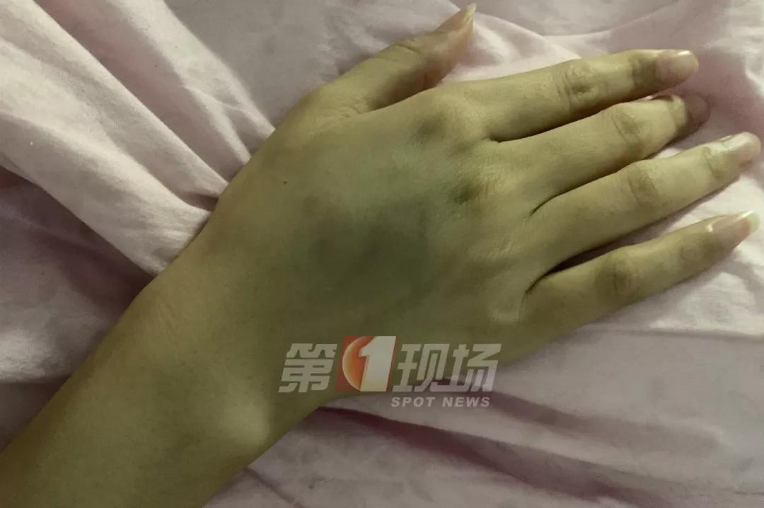 投诉快递员遭上门暴打后续,投诉快递员遭入室暴打