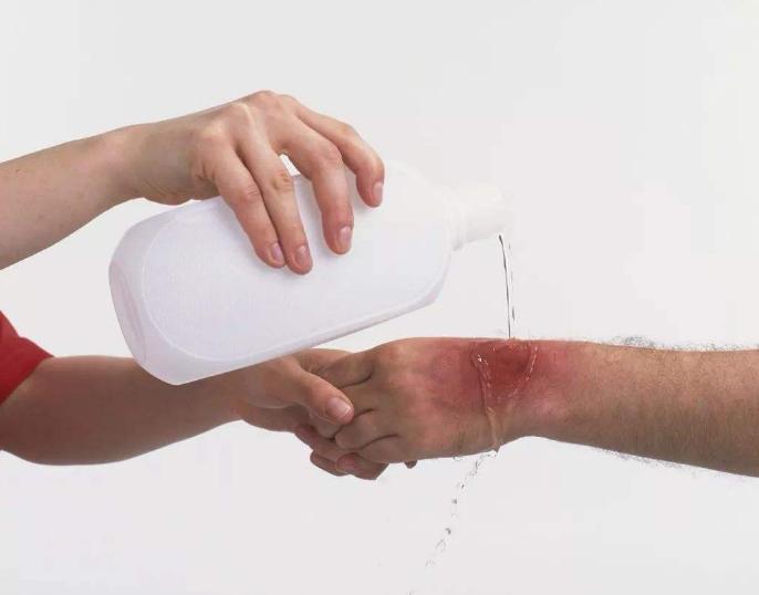 当孩子被烫伤时，用这5个步骤缓解