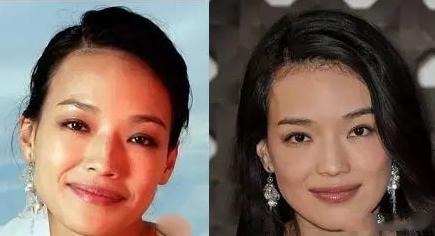 脸大怎么办自救方法,颅顶低的女生拯救办法