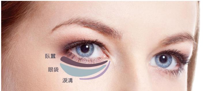 眼袋越来越严重赶紧试试这个方法,大家是否知道眼袋形成的原因呢