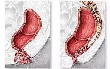 一颗痔疮肿起来一圈,一颗痣引发的血案