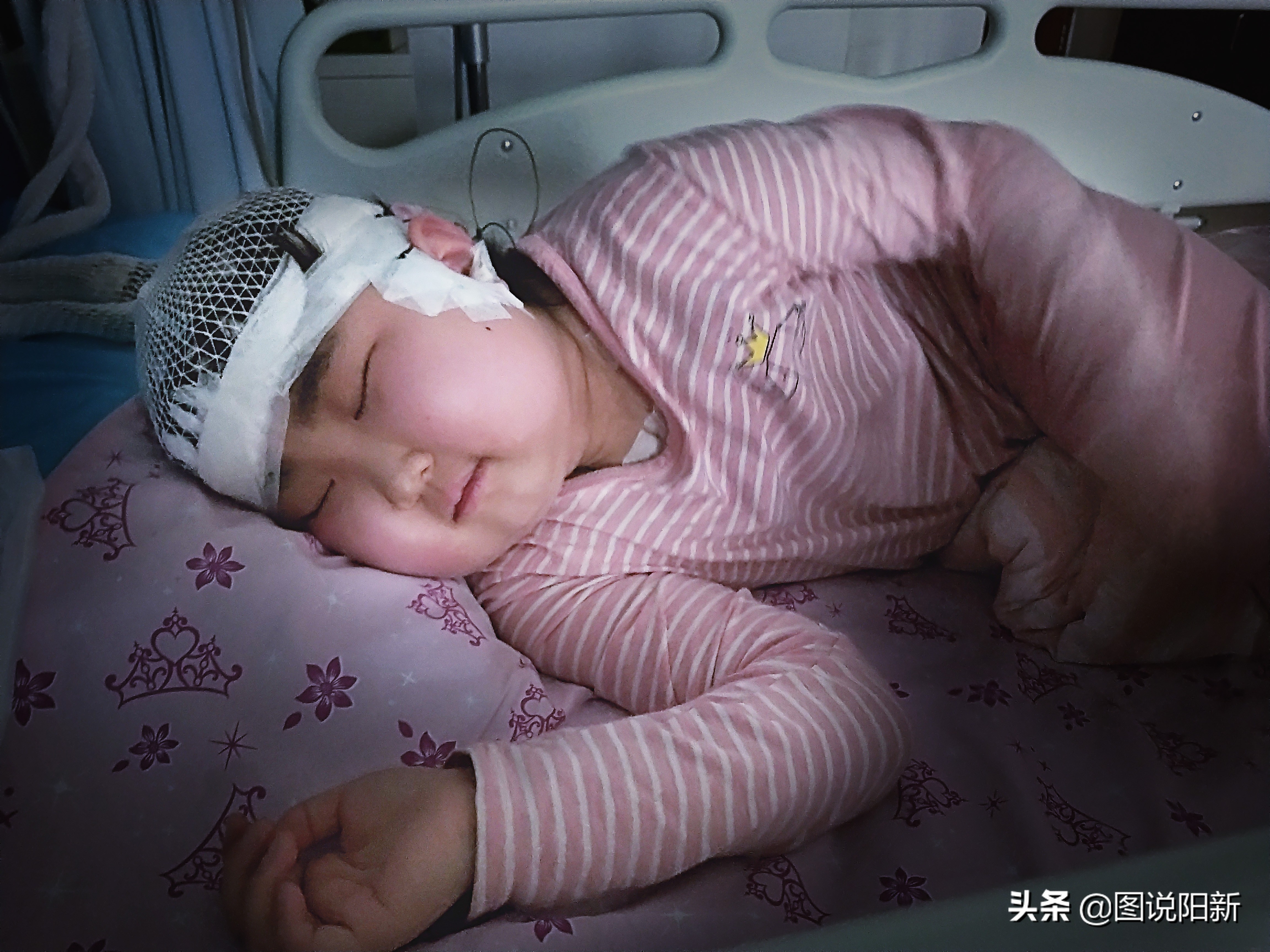 女孩患了200万分之一罕见病,女孩身患罕见怪病