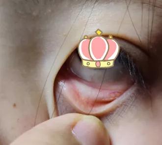 璋﹀窛涓尰,鏉窞璋﹀窛涓尰