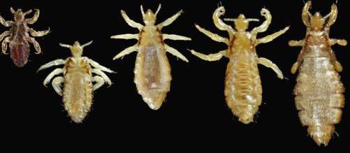 鸡虱怎么根除最快,鸡羽虱最好治疗方法