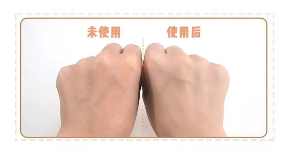 不打美白针还有哪些美白项目,快速美白内调不用美白丸