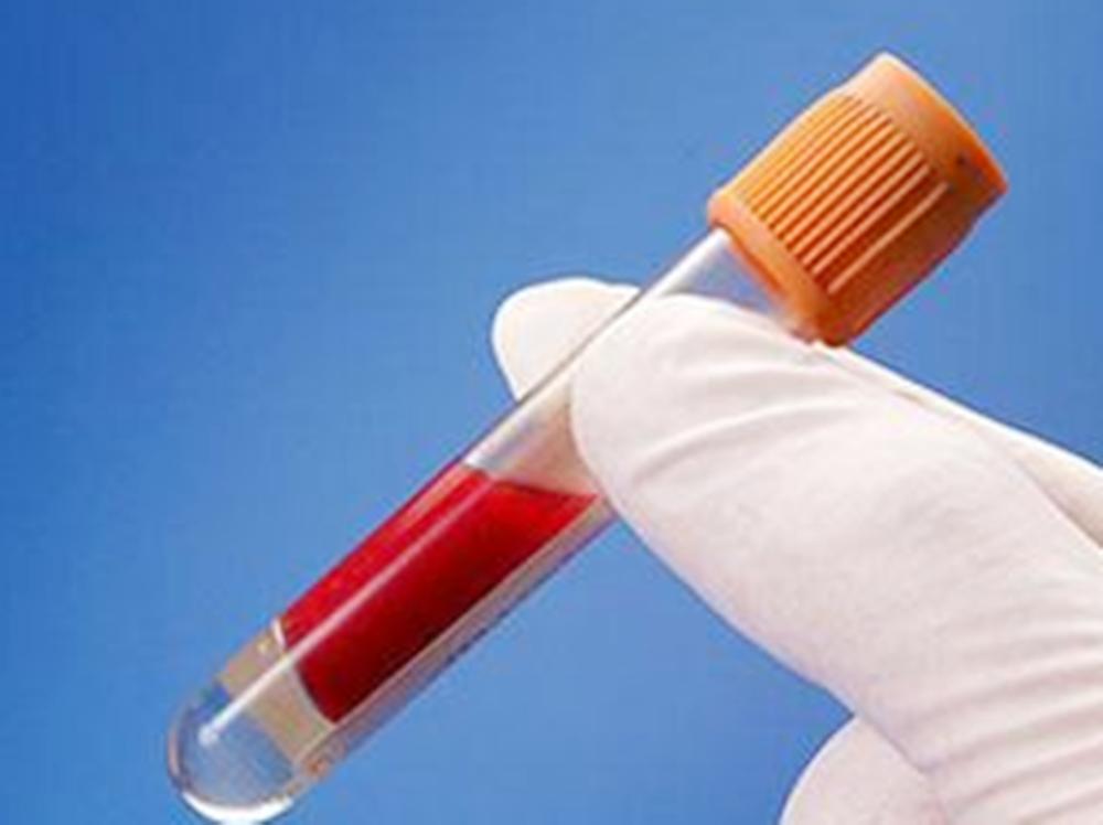 停经多少天看出胎心胎芽,停经多久判断为宫外孕