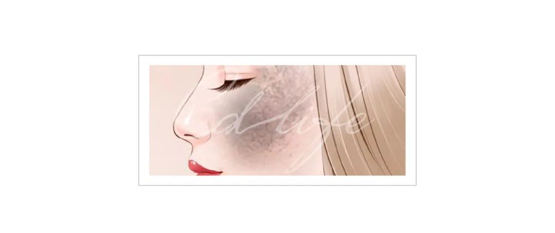 不做黄脸婆教你如何淡化色斑,色斑修复的最佳方法