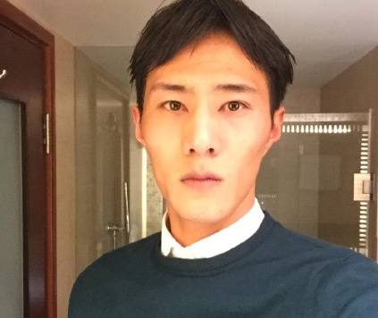 明星身上的伤疤,高晓松手臂的烟疤