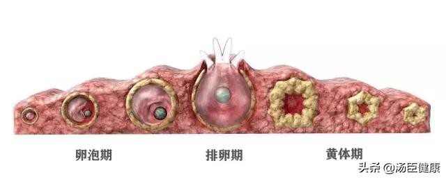 上厕所黄体破裂,黄体破裂出血上厕所会有血块