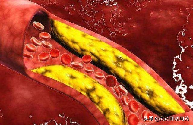 冠心病的六种常用药如何正确服用,关于冠心病中药处方