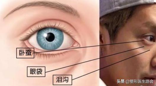 祛眼袋泪沟最靠谱的方法,遮眼袋泪沟最好用的方法