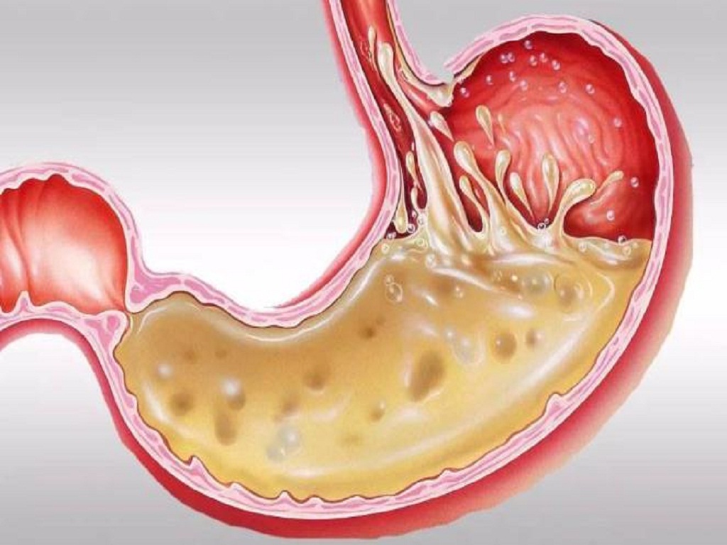 不正确的刷牙多久会形成楔状缺损,不正确的刷牙方式导致牙根外露