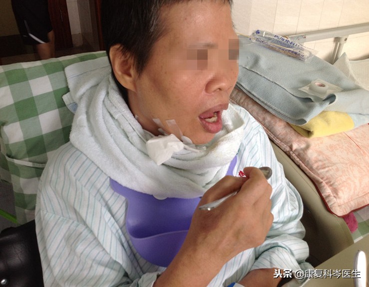 中风后吞咽障碍怎么康复,中风后吞咽困难中医的治疗方法