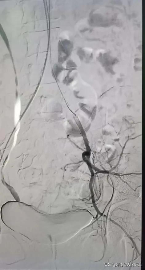 爬雪山过草地跨学科,爬雪山过草地历经二万五千里