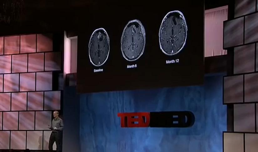 癌细胞电场疗法,内置电场杀死癌症细胞