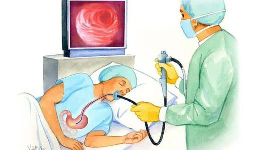 做胃镜没有想象得那么可怕,做胃镜很痛苦听听专家详解