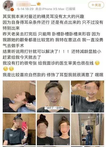 被整容害惨的网红,被整容毁掉的女明星