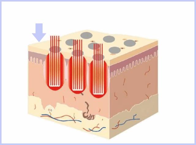 如果被祛痘机构坑了怎么办,我被私立医院骗了怎么办