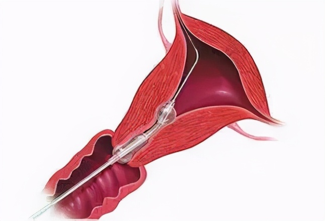 科普知识马桶,马桶管道科普
