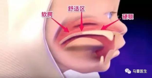 马蕾哺乳专家,马蕾医生科普视频