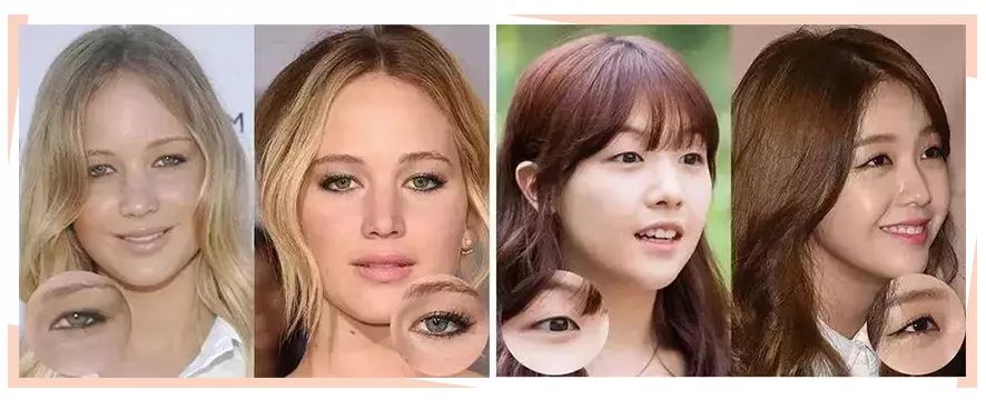 睫毛翘睫术怎么弄直,睫毛短小妙招