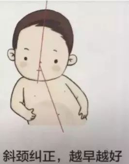 怎么防止宝宝歪脑袋睡导致斜颈,两岁宝宝稍微斜颈的症状和图片