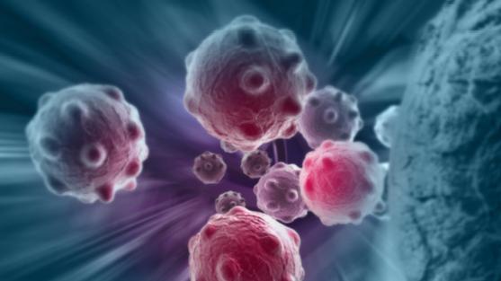 槟榔一级致癌物是国家规定的吗,槟榔是一级致癌物质是真的吗