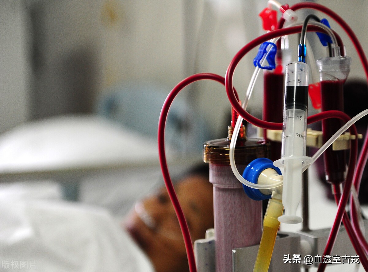 内瘘血肿,穿刺后皮下血肿怎么处理