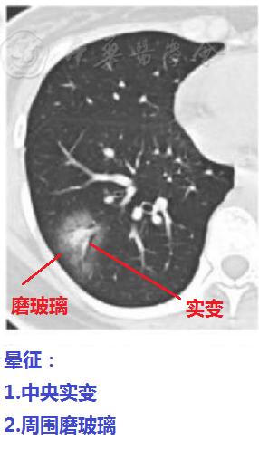 磨玻璃阴影怎么处理,磨玻璃阴影