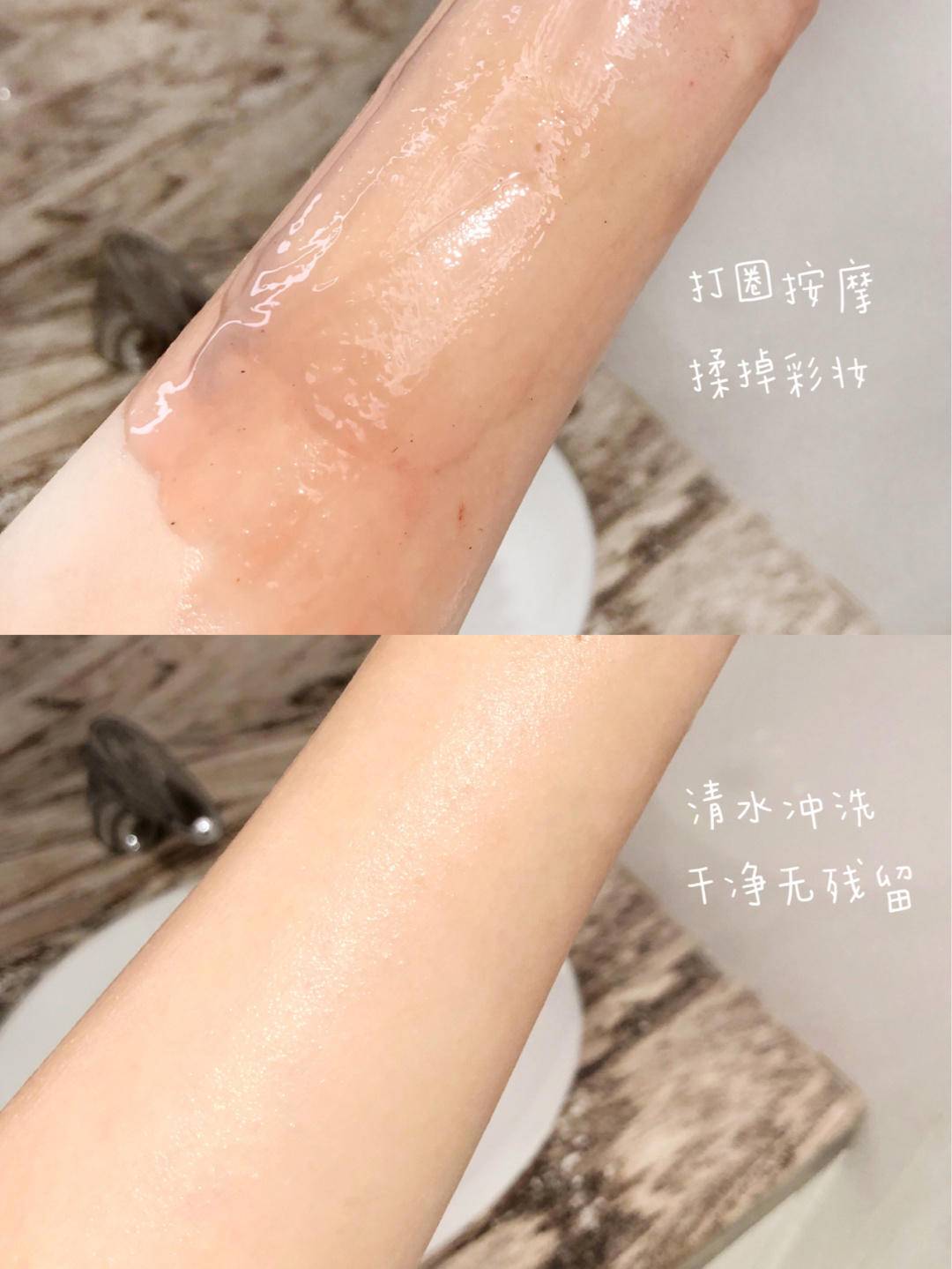 混合性肌肤t区出油怎么办,混合皮肤t区出油是什么原因