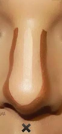 鼻头大怎么改善变小,鼻子不好看怎么办隆鼻