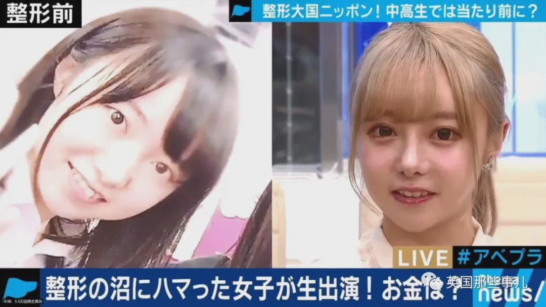 20岁漂亮女子花6万整容鼻子失败,19岁少女花百万整容