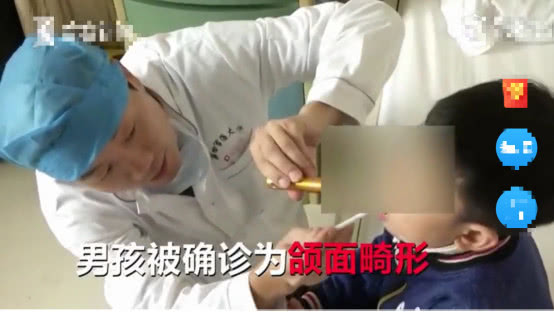 5岁男童张嘴睡觉用嘴呼吸正常吗,小孩反复张嘴闭嘴