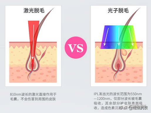 你能分辨不同的颜色吗,怎么区分光子嫩肤仪和脱毛仪