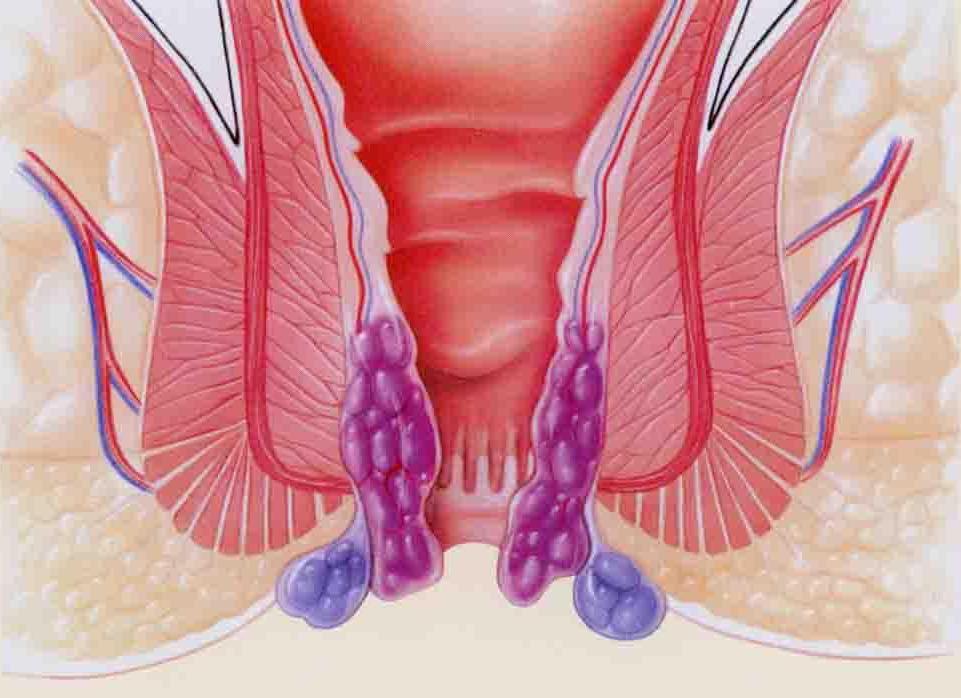 屁多身上起疙瘩怎么回事,小孩屁多眼痒有疙瘩