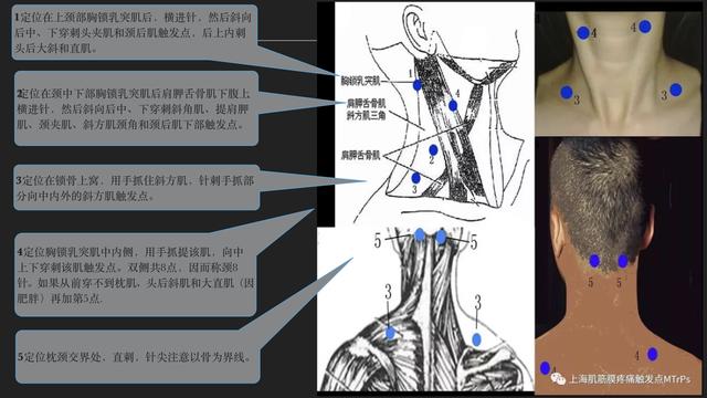 大道至简治疼痛,大道至简举步维艰