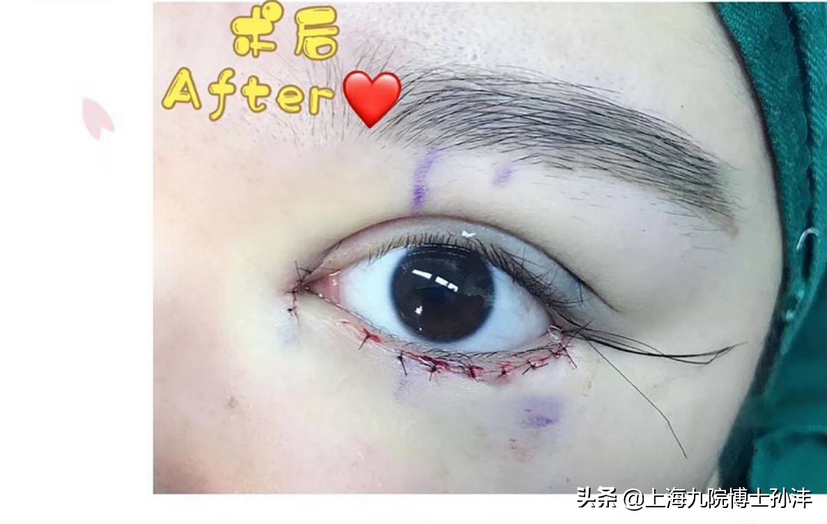 瀛欐玻鍗氬＋妗堜緥,瀛欐玻鍗氬＋