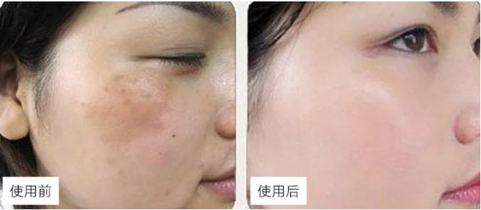 在国外比国内便宜的国货,在国外买的最火的中国产品