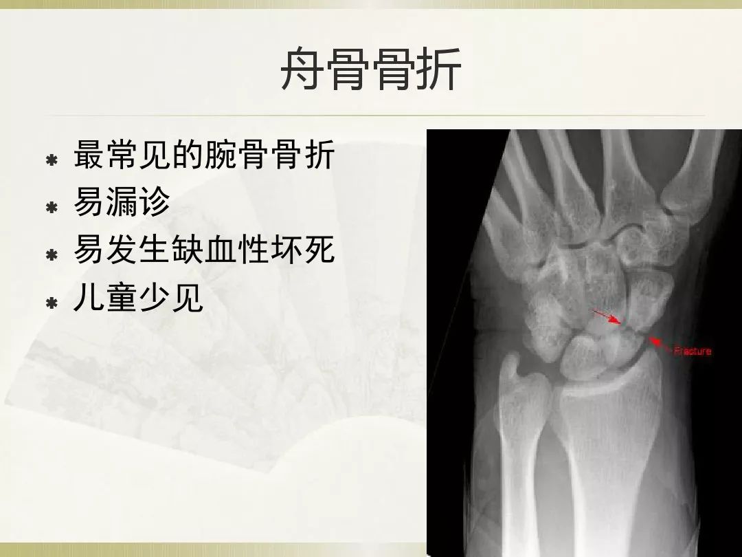 骨科x光片读片技巧,放射科骨科读片教程