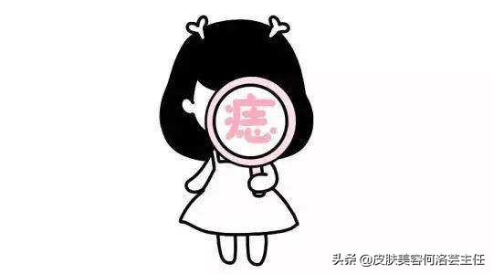 为什么色素痣会越来越多,有无色素痣都要注意什么