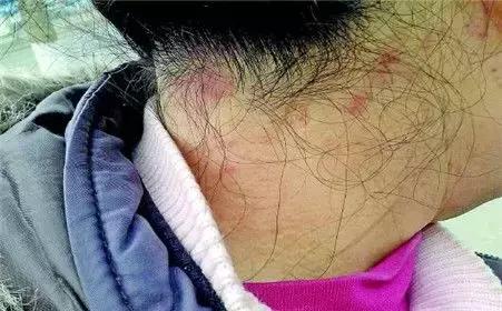 染发剂都会致癌吗,染发剂致癌是真的吗