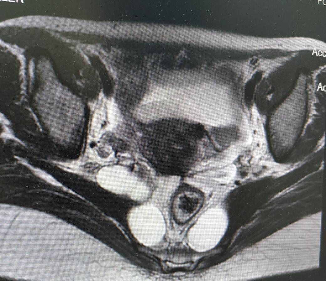 病例分享小结,病例分享及讨论