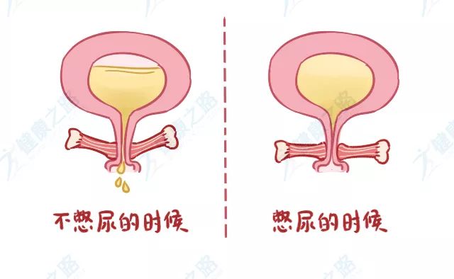 松了咋办,太松怎么收紧的妙招