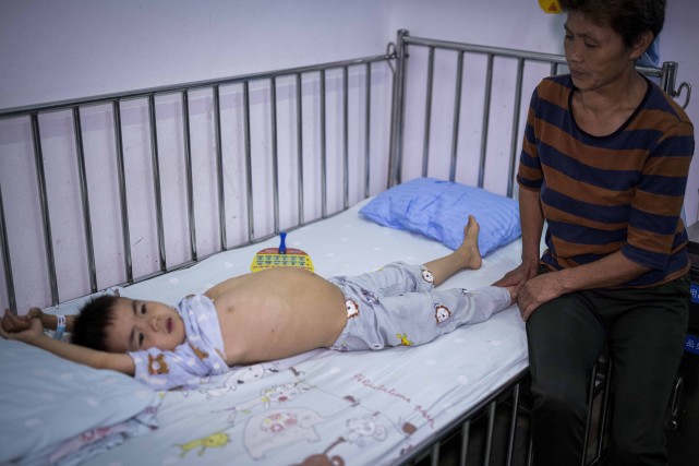 湖南8岁男孩体重仅40斤,小伙4岁失去双臂父亲精神失常