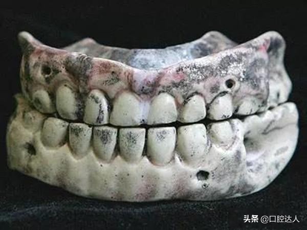 最全的牙科历史发展，牙医们大喊惊讶