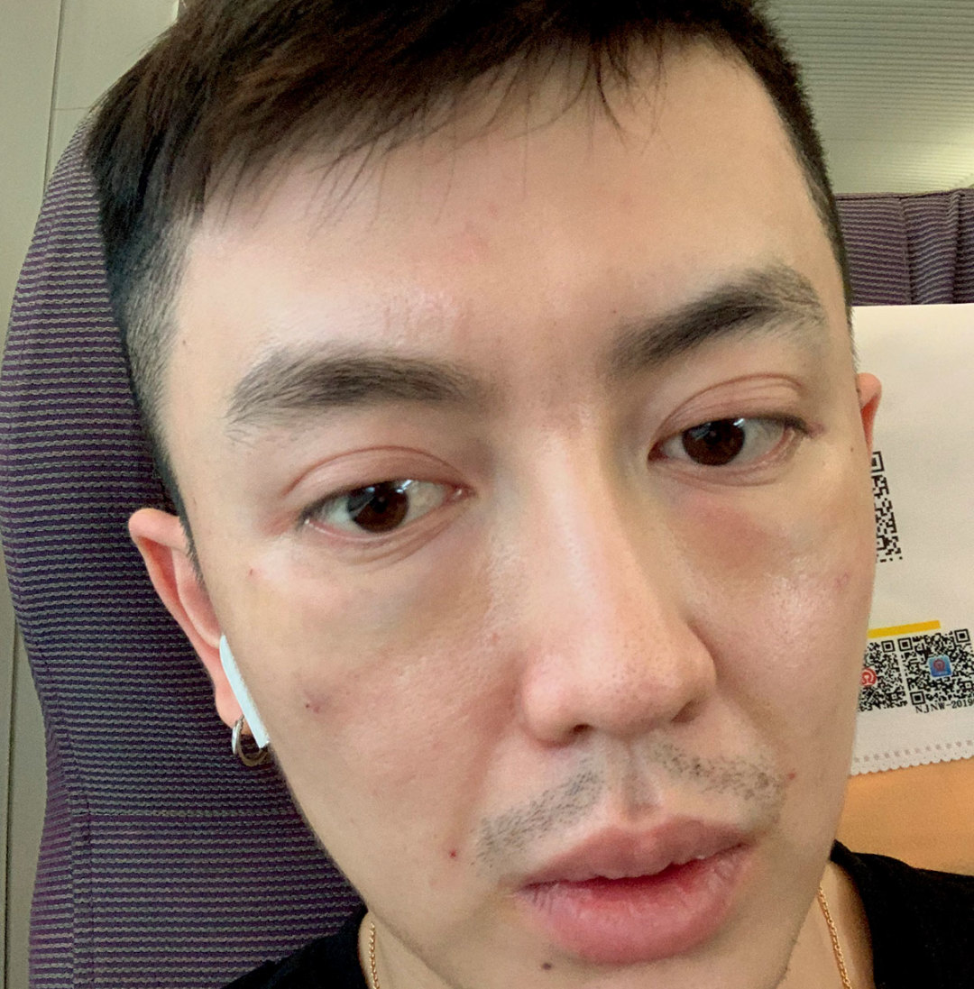 整形到底是失败还是毁容,美容变毁容完整版