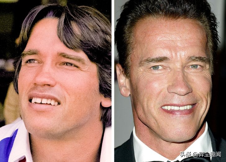 做牙齿美白的明星,明星的牙齿美白